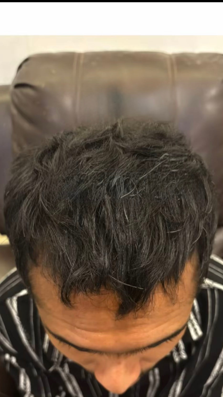 After photo
